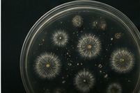 Microbial diversity